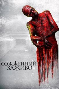Сожженный заживо