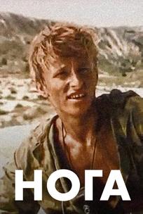 Нога